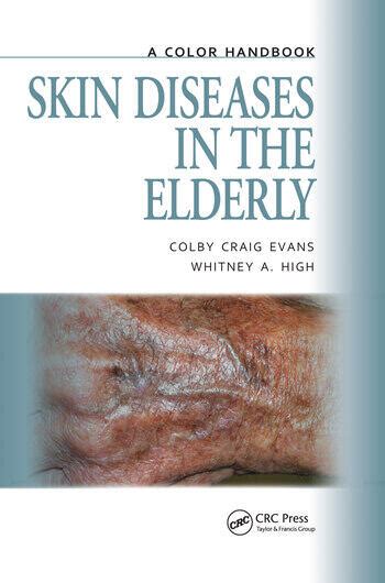 Skin diseases in the elderly a color handbook medical color handbook series. - Business statistics final exam study guide.