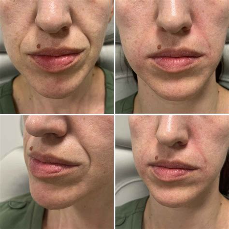 Skin envy medspa. .  <a href=https://7w.gaga.guru/assets/images/qcwqlq/in...