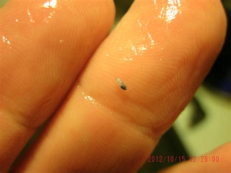Skin fungus gnat larvae in humans. Things To Know About Skin fungus gnat larvae in humans. 