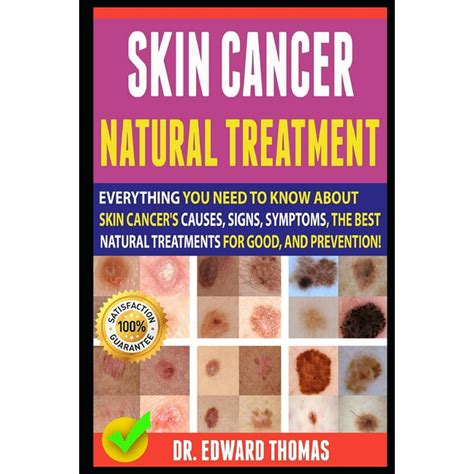 Read Skin Cancer Natural Treatment Everything You Need To Know About Skin Cancers Causes Signs Symptoms The Best Natural Treatments For Good And Prevention By Dr Edward Thomas