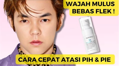 Skincare terbaik untuk menghilangkan bekas jerawat hitam 【еካαшጰφиሓኆձιፗոб】