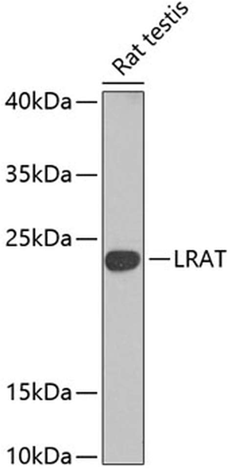 LRAT (lecithin:retinol acyltransferase), an enzyme whose levels are modulated during malignant conversion, has been reported as the founder member of a new LRAT-like family that includes tumor suppressors TIG-3(1-164) and Ha-Rev107(1-162). The mechanisms that link these three proteins to carcinogene …. 