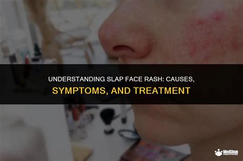 Slap Face Onlyfans Leak