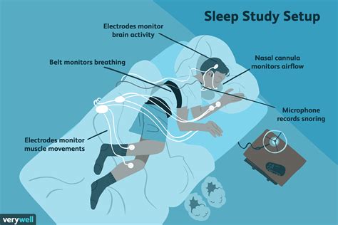 Sleep Study (Polysomnogram) What to Expect