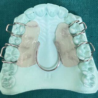 Slow maxillary expansion: A review