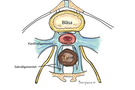 Smärta i ligament inguinale - BakingBabies