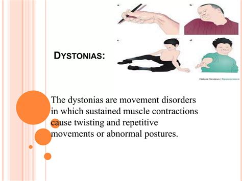 Smacking lips seizure.  Dystonic seizures cause sustained twisting postures, where musc...