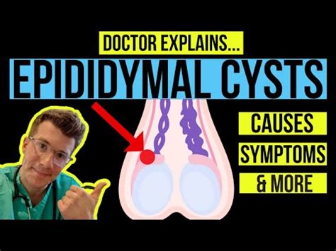 Small epididymal cyst HealthTap Online Doctor