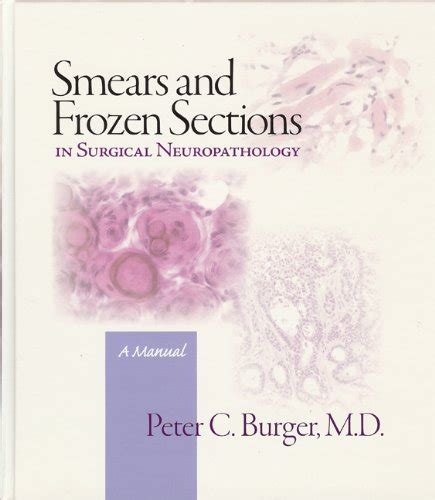 Smears and frozen sections in surgical neuropathology a manual. - Lösungen handbuch chemie braun und lemay.
