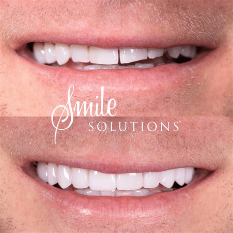 Smile Solutions Provider Number