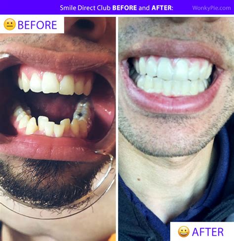 Smile direct club near me. 9:46am Dec 14, 2023. Australians who have purchased teeth-aligner treatments with SmileDirectClub will not be offered customer care support, after the business shutdown operations this week. The ... 