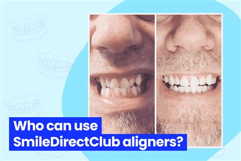 Smiles direct. SmileDirectClub is an oral care company that exists to help more people realize the life-changing potential of their smiles. We’re the creators of the first teledentistry platform for teeth ... 