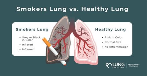 Smokers lungs video.  It&rsquo;s a common misconception that keeps peo...
