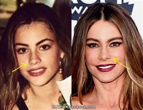 Jan 24, 2024 ... Vergara's physical transformation for the show included fake eyebrows, a fake nose and even fake teeth (which explains why Vergara looks so .... 