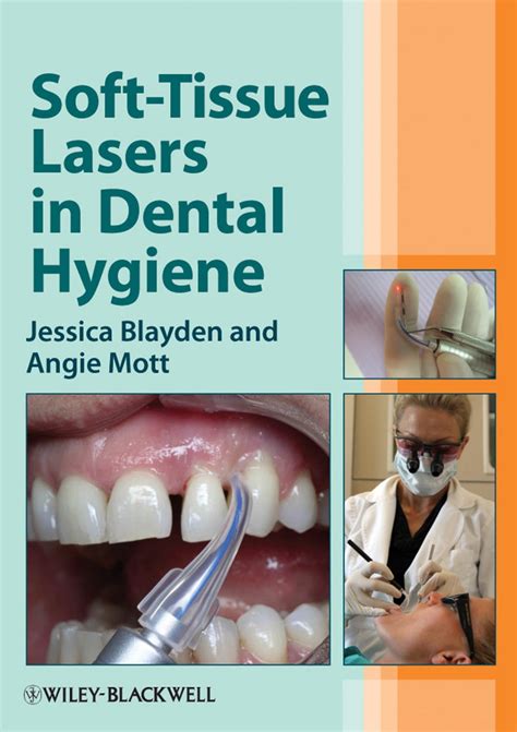 Read Softtissue Lasers In Dental Hygiene By Jessica Blayden