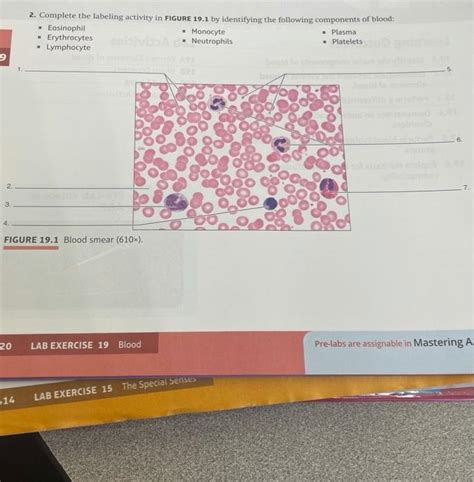 Solved 2. Complete the labeling activity in FIGURE 19.1 by