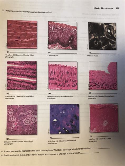 Solved Chapter 5 Histology Name Date Section POSTLABOR...