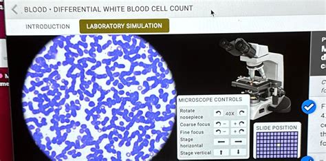 Solved ERENTIAL WHITE BLOOD CELL COUNT LABORATORY SIMULATION
