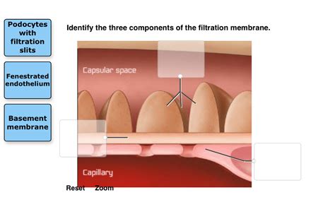 Solved Podocytes with filtration slits Identify the three