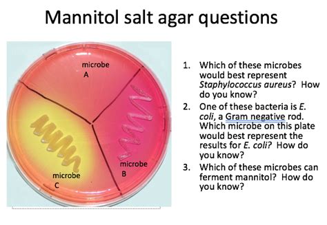 Solved QUESTIONS Mannitol salt agar (MSA) is considered a