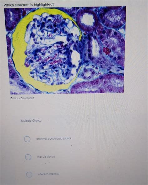 Solved The proximal convoluted tubule is 6 Multiple Choice