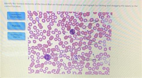 Solved Three types of formed elements found in blood include