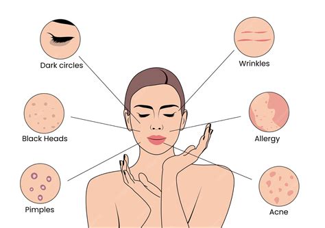 Solving Skin Problems