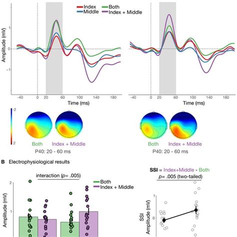 Somatosensory Evoked Potentials Article - StatPearls