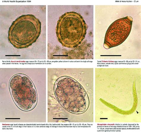 Some of the Parasites that Can Be Found in Stool Test. Download