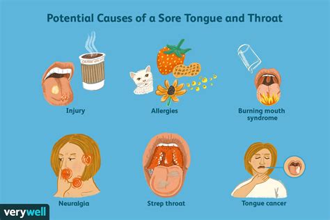 Sore mouth/burning tongue caused by stress/anxiety