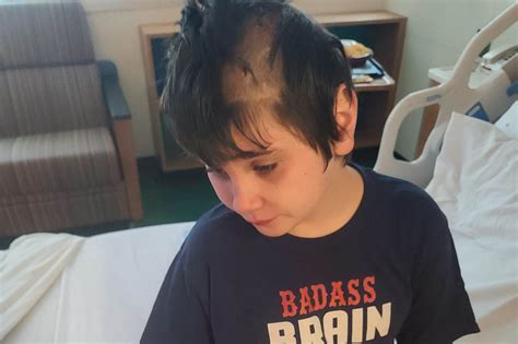 Southern California boy undergoes brain surgery after getting hit by baseball