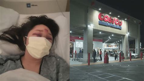 Southern California woman describes being dragged by Costco purse snatcher