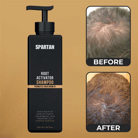Spartan root activator shampoo. Spartan Shampoo,Root Activator Shampoo,Renew Hair Growth,Shampoo Root Activator,Promotes Hair Growth (Color : 2pcs) 2 offers from $22.31. Fortero Hair Growth Shampoo for Men – Haircare to Fight Baldness – Shampoo for Fast Hair Growth and Strong, Healthy Hair (1 Pack) 