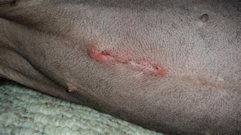 Spay incision infection pictures. Things To Know About Spay incision infection pictures. 