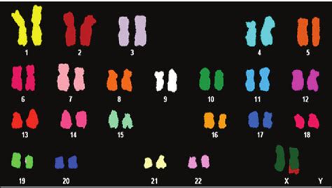 Spectral Karyotyping - an overview ScienceDirect Topics