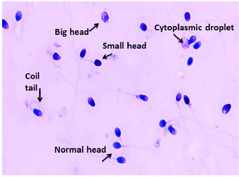 Sperm stain. Six sperm staining methods, including Papanicolaou, Diff-Quik, Shorr, Hematoxylin–eosin (HE), Wright, and Wright-Giemsa staining, were used to stain the sperm smears of 25 semen samples, respectively. Sperm head parameter's length (L), width (W), area (A), perimeter, acrosomal area (Ac), and the derived values L/W and … 