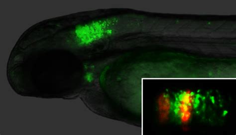 Spinal cord PLOS ONE