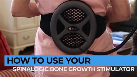Spinalogic Bone Growth Stimulator Price