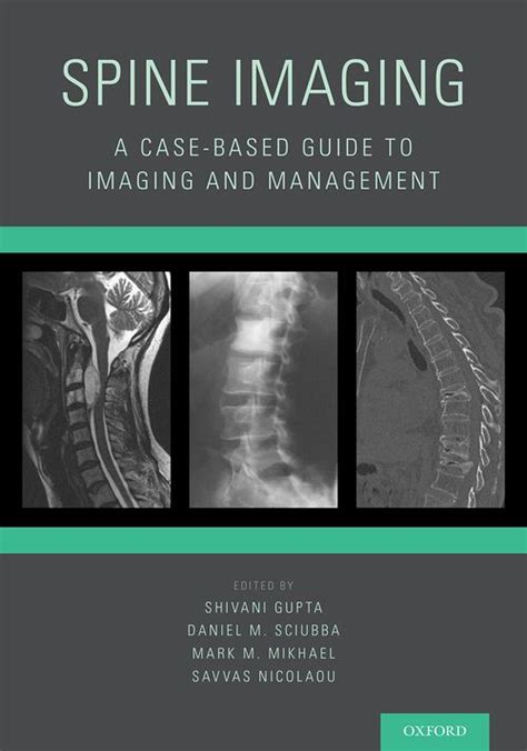 Spine imaging a case based guide to imaging and management. - Comfortmaker furnace manual model g u.
