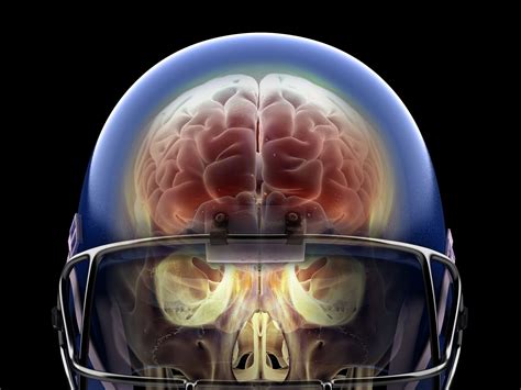 Sports concussions debate: Does CTE really exist? - ScienceDaily