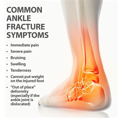 Sprained your ankle — now what?
