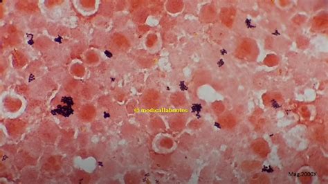 Staphylococcus and Micrococcus Introduction, Differentiating Fea