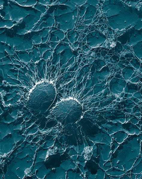 Staphylococcus aureus Vikipedi. 