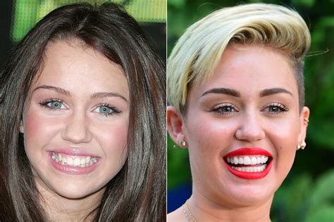Stars who have false teeth. Like their predecessors, the big names of today are known for their sparkling white, super-straight teeth. The treatments the stars undergo have filtered down into all sections of society with everyone wanting a classic Hollywood smile. Cosmetic dentistry is hugely popular and its appeal is fuelled by the perfect teeth we see on celebrities. 