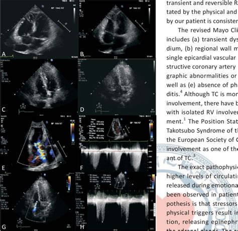 State-of-the-Art Review of Echocardiographic Imaging in …