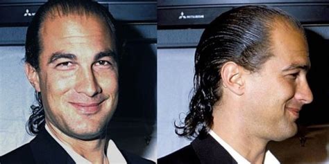 Seagal has been gradually losing his hair since his debut in the early 1990s, and is now almost completely bald. Seagal’s height and hair loss have become a trademark of sorts …. 
