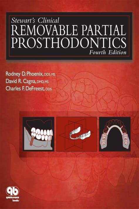 Read Online Stewarts Clinical Removable Partial Prosthodontics By Rodney D Phoenix