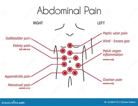 Stomach Pain Diagram