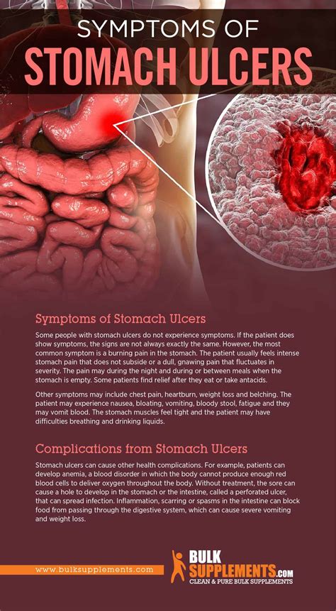 Stomach Ulcers & Gastritis Center for GI Health