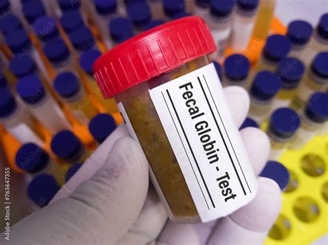 Stool sample for Fecal Globin by Immunochemistry test to detecting